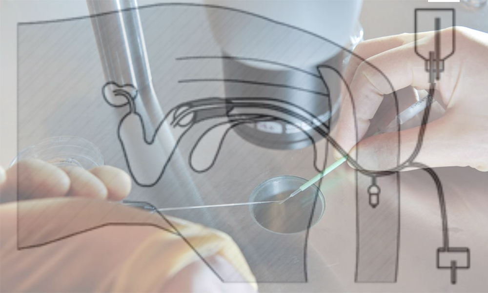 Embryotransfer