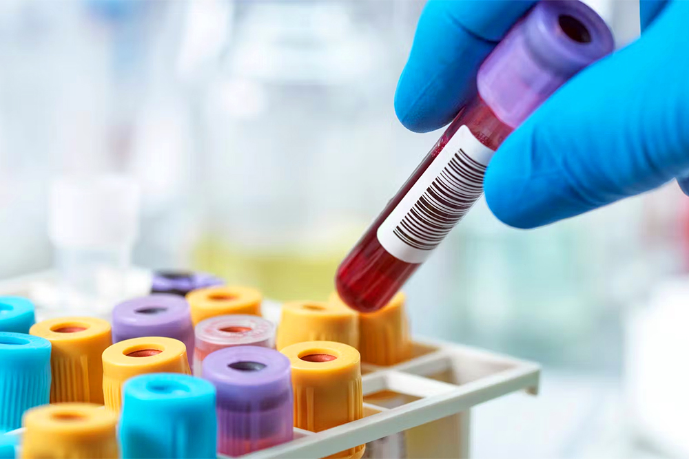 Positive WM-Probe: Wann ist clean wirklich clean?